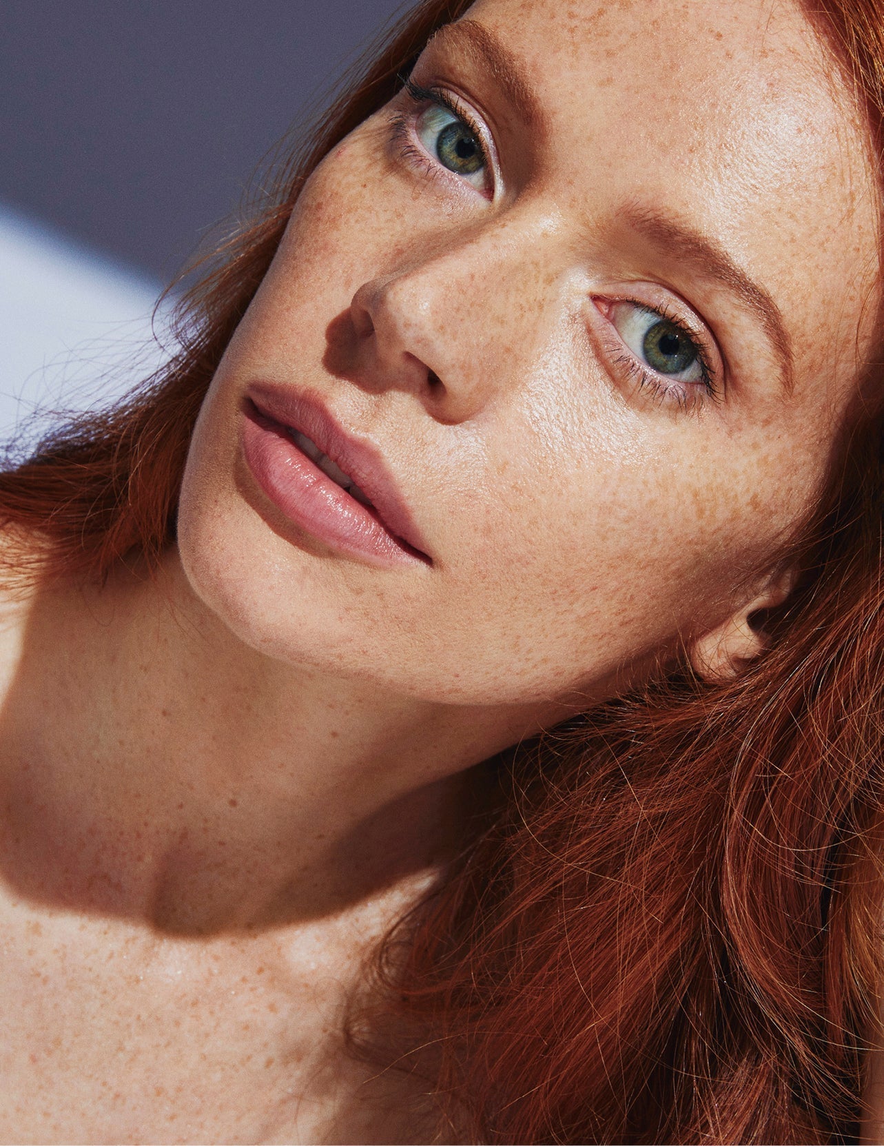 遇到色素沉着的问题？这就是如何淡化突发事件后的黑斑